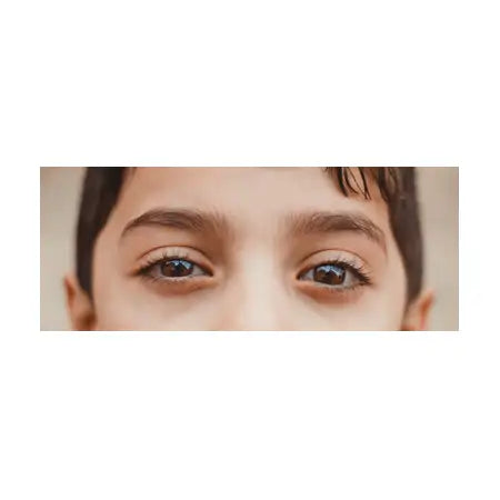 sore eyes in child