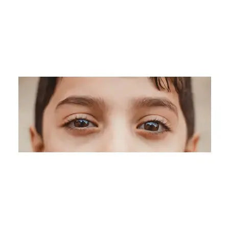 close-up of child’s eyes, healthy eye area, clear skin, natural light, eye care concept