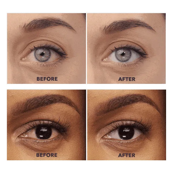 Lumify Eye Drops 7.5ml | Safe Rapid Red Eye Relief - mEYEspa