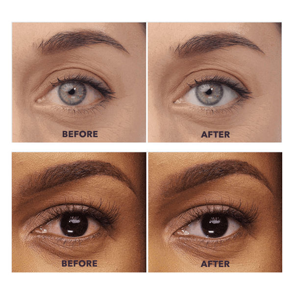 Before and after close-up photos showing reduced eye redness after eye drops use